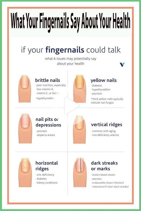 livery nails|fingernail health warning signs.
